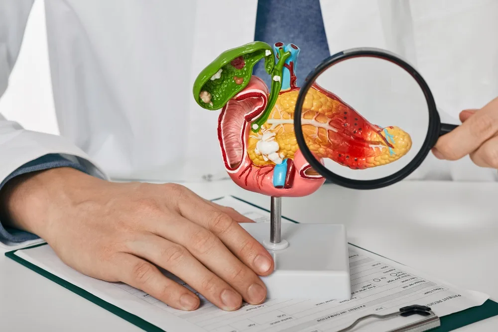 Diagnosis and Pancreatitis Radiology